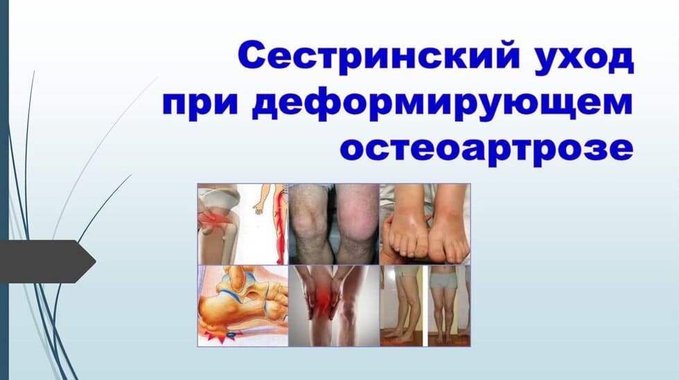 догляд при остеоартрозі